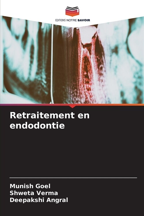 Retraitement en endodontie (Paperback)