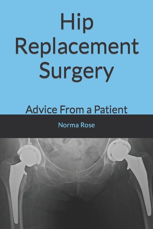 Hip Replacement Surgery: Advice From a Patient (Paperback)