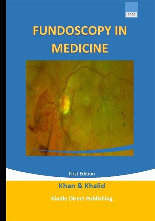 Fundoscopy in Medicine (Paperback)