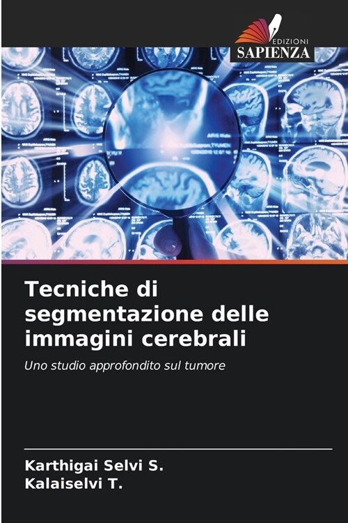 Tecniche di segmentazione delle immagini cerebrali (Paperback)