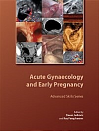 Acute Gynaecology and Early Pregnancy (Hardcover)