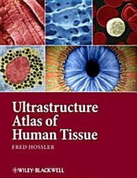 Ultrastructure Atlas of Human Tissues (Hardcover)