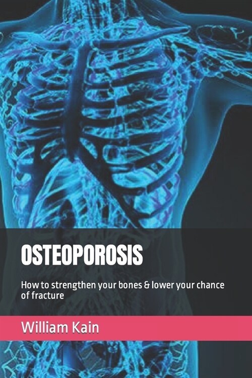 Osteoporosis: How to strengthen your bones & lower your chance of fracture (Paperback)