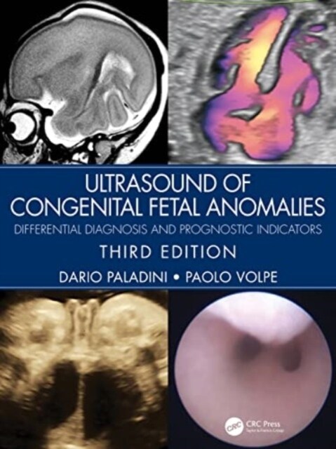 Ultrasound of Congenital Fetal Anomalies : Differential Diagnosis and Prognostic Indicators (Hardcover, 3 ed)