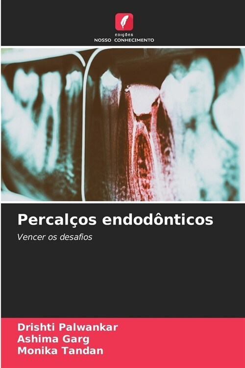 Percal?s endod?ticos (Paperback)