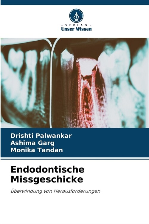 Endodontische Missgeschicke (Paperback)