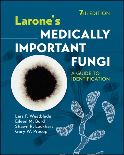 Larones Medically Important Fungi: A Guide to Identification (Hardcover, 7)