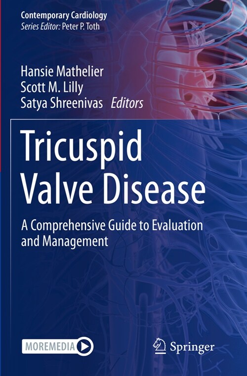 Tricuspid Valve Disease: A Comprehensive Guide to Evaluation and Management (Paperback, 2022)