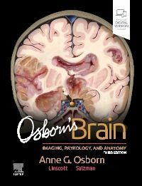Osborns Brain (Hardcover, 3 ed)