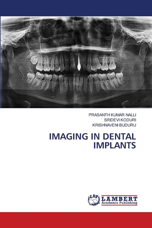 Imaging in Dental Implants (Paperback)