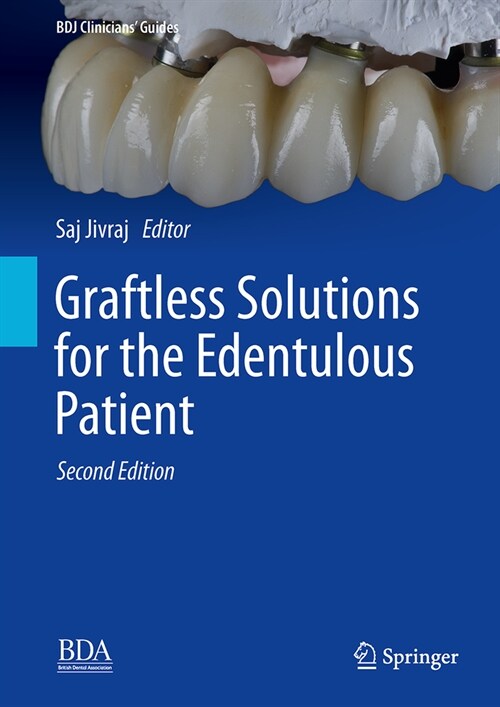 Graftless Solutions for the Edentulous Patient (Hardcover, 2, 2023)