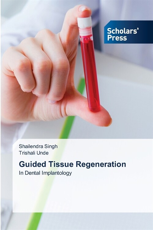 Guided Tissue Regeneration (Paperback)