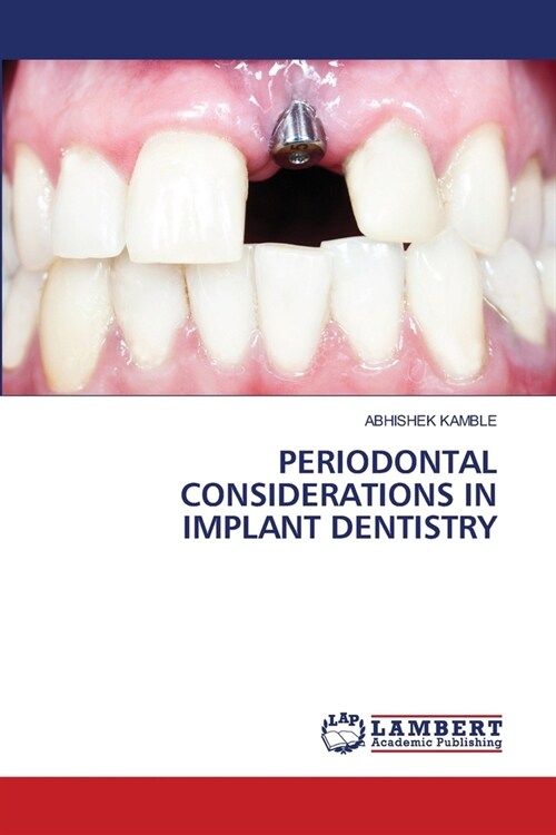 Periodontal Considerations in Implant Dentistry (Paperback)