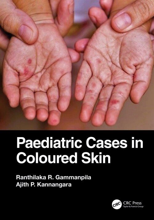 Paediatric Cases in Coloured Skin (Paperback, 1)