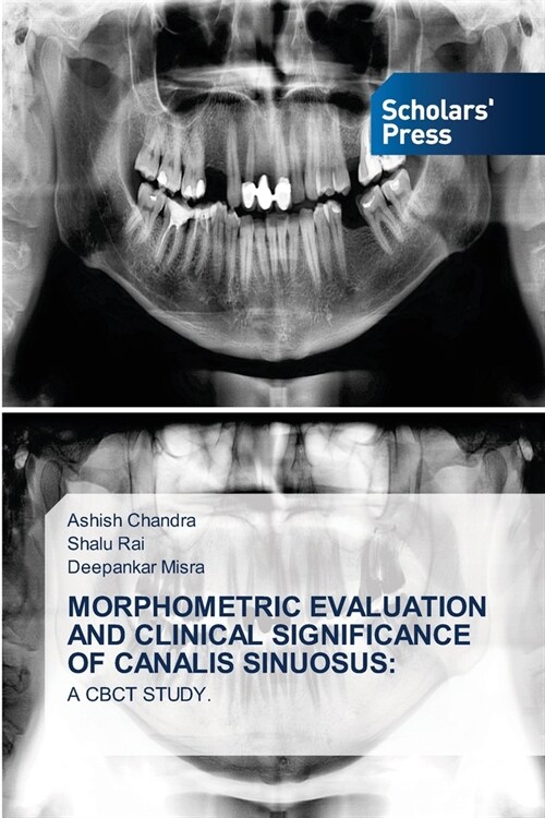 Morphometric Evaluation and Clinical Significance of Canalis Sinuosus (Paperback)