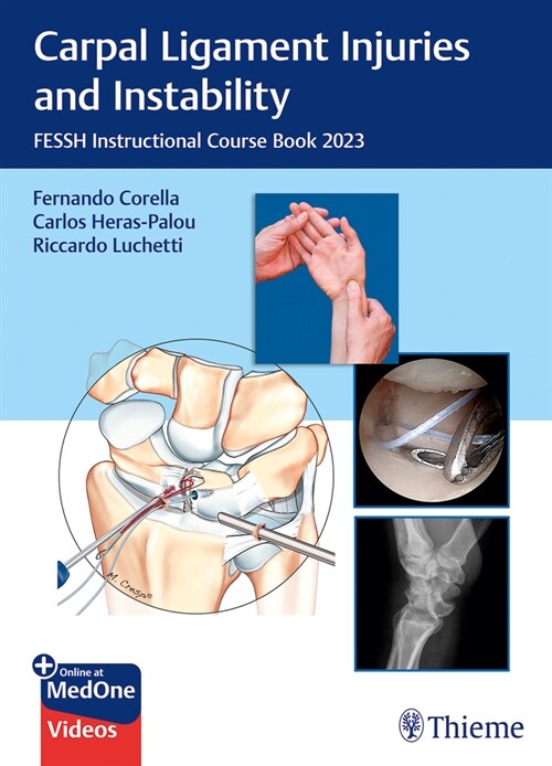 Carpal Ligament Injuries and Instability: Fessh Instructional Course Book 2023 (Hardcover, 1. Auflage)