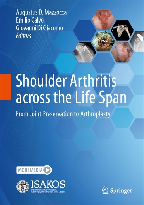 Shoulder Arthritis Across the Life Span: From Joint Preservation to Arthroplasty (Hardcover, 2023)