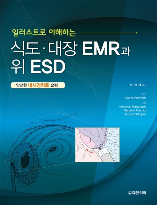 일러스트로 이해하는 식도·대장 EMR과 위