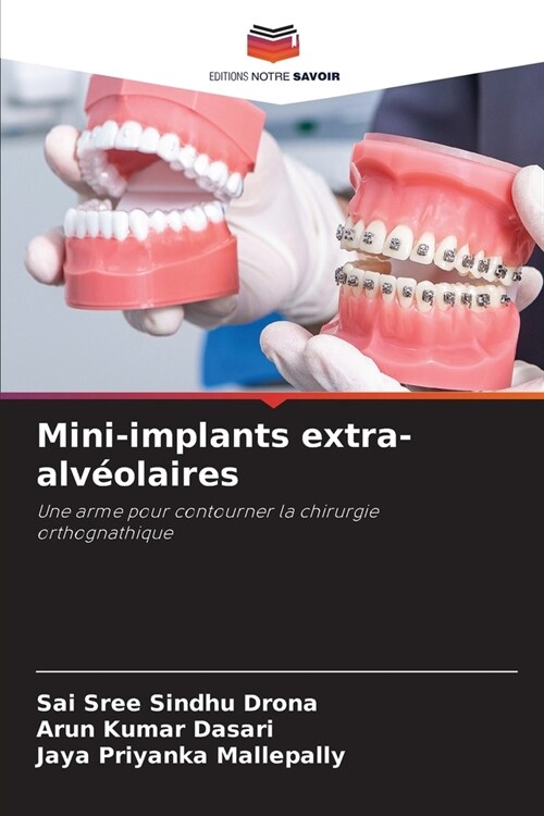 Mini-implants extra-alv?laires (Paperback)