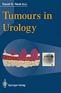 Tumours in Urology (Paperback)