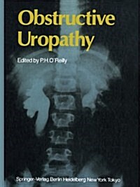 Obstructive Uropathy (Paperback, Softcover reprint of the original 1st ed. 1986)