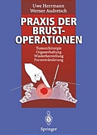 Praxis Der Brustoperationen: Tumorchirurgie -- Organerhaltung -- Wiederherstellung -- Formver?derung (Paperback, Softcover Repri)