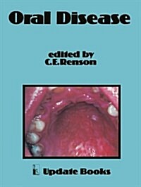 Oral Disease (Paperback)