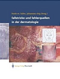 Fallstricke Und Fehlerquellen in Der Dermatologie (Paperback, Softcover Repri)