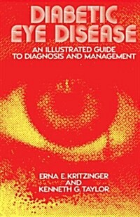 Diabetic Eye Disease: An Illustrated Guide to Diagnosis and Management (Paperback, Softcover Repri)