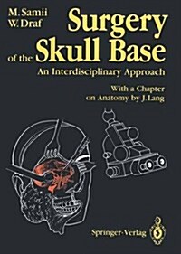 Surgery of the Skull Base: An Interdisciplinary Approach (Paperback, Softcover Repri)