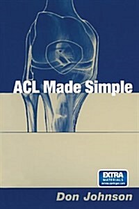 ACL Made Simple (Paperback, Softcover Repri)