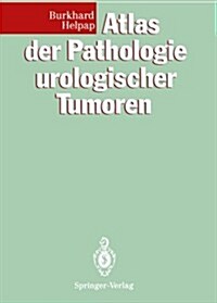 Atlas Der Pathologie Urologischer Tumoren (Paperback)
