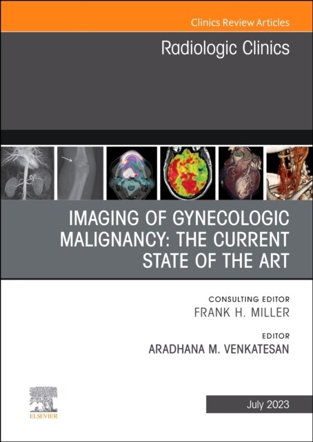 Imaging of Gynecologic Malignancy: The Current State of the Art, an Issue of Radiologic Clinics of North America: Volume 61-4 (Hardcover)