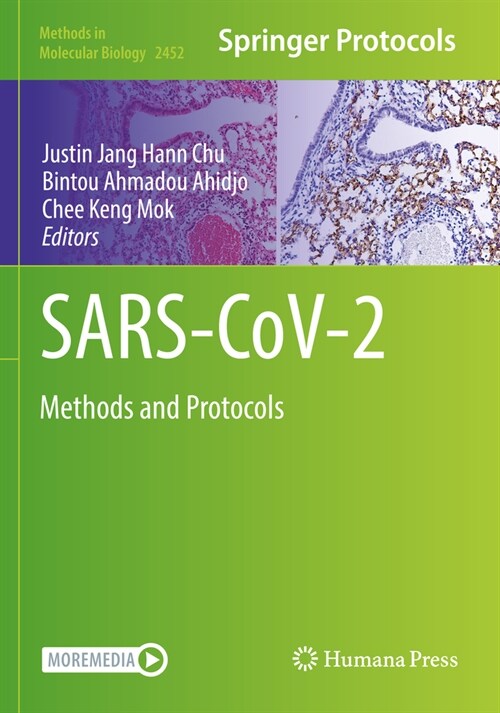 Sars-Cov-2: Methods and Protocols (Paperback, 2022)