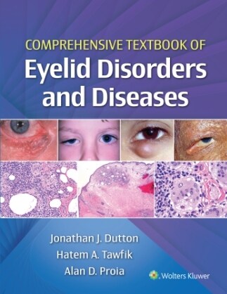 [eBook Code]Comprehensive Textbook of Eyelid Disorders and Diseases (1st)