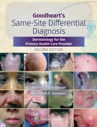 [eBook Code]Goodhearts Same-Site Differential Diagnosis (2nd)