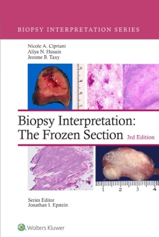 [eBook Code]Biopsy Interpretation: The Frozen Section (Biopsy Interpretation Series) (3rd)