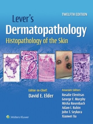 [eBook Code]Levers Dermatopathology (12th)