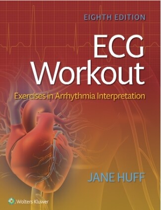 [eBook Code]ECG Workout (8th)