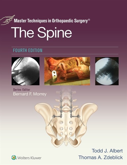 [eBook Code]Master Techniques in Orthopaedic Surgery: The Spine (Master Techniques in Orthopaedic Surgery) (4th)
