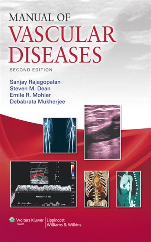 [eBook Code]Manual of Vascular Diseases (2nd)