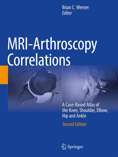 MRI-Arthroscopy Correlations (Paperback, 2nd)