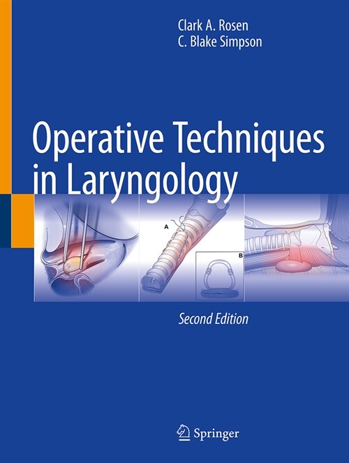 Operative Techniques in Laryngology (Hardcover, 2, 2024)