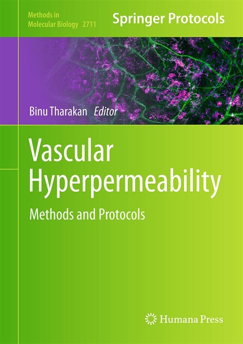 Vascular Hyperpermeability: Methods and Protocols (Hardcover, 2024)