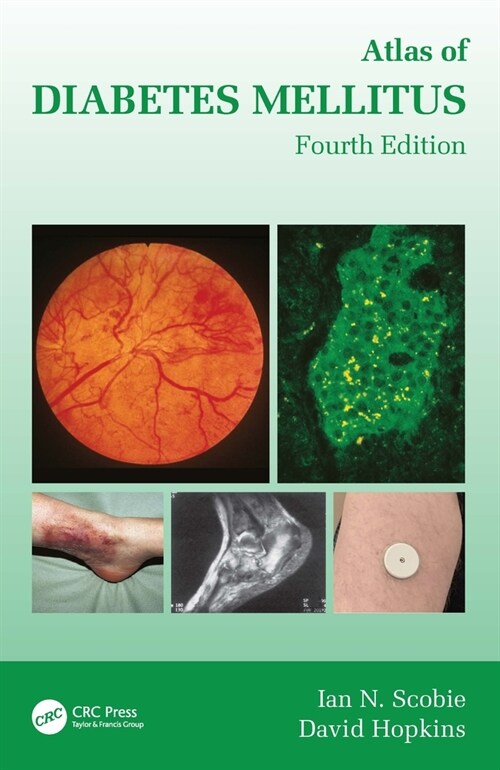 Atlas of Diabetes Mellitus (Hardcover, 4 ed)