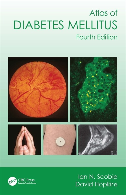 Atlas of Diabetes Mellitus (Paperback, 4 ed)
