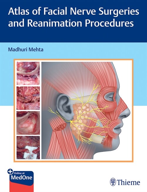 Atlas of Facial Nerve Surgeries and Reanimation Procedures (Hardcover)