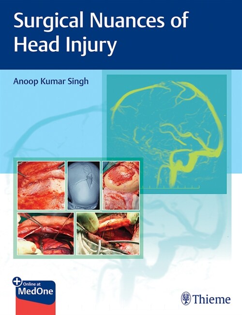 Surgical Nuances of Head Injury (Hardcover)