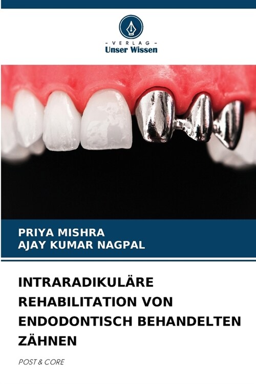 Intraradikul?e Rehabilitation Von Endodontisch Behandelten Z?nen (Paperback)