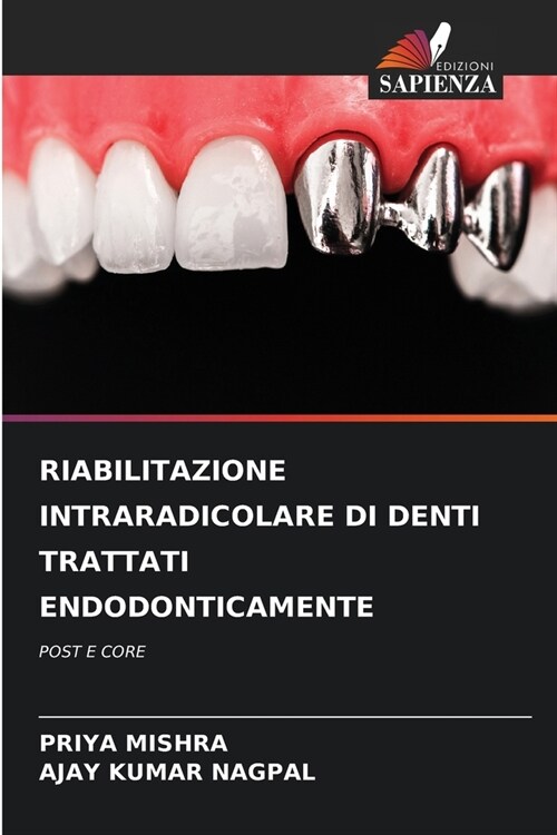 Riabilitazione Intraradicolare Di Denti Trattati Endodonticamente (Paperback)